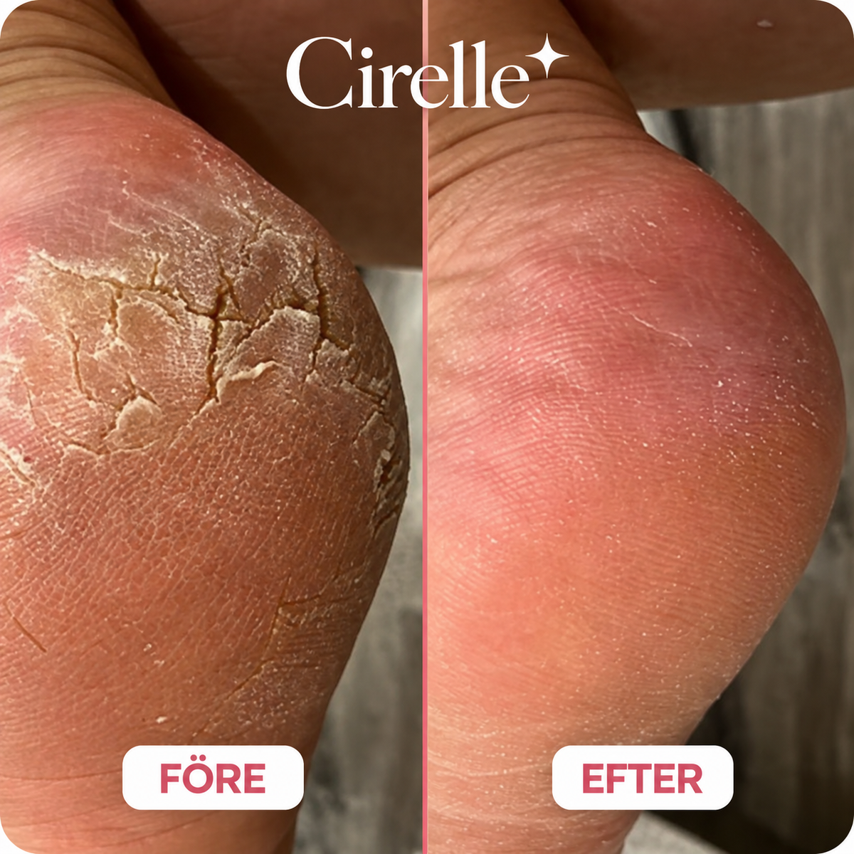 ✨SilkGlow Repair Balm - Återfuktande Fotkräm