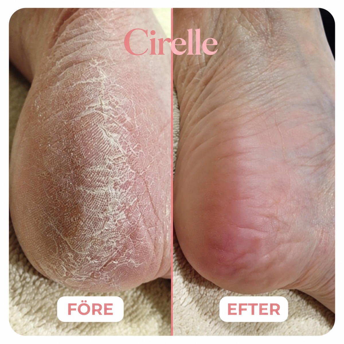 ✨SilkGlow Repair Balm - Återfuktande Fotkräm